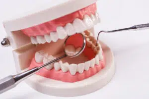 Oral Surgery Pierce County 