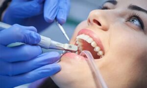 signs-you-need-a-root-canal-treatment-1