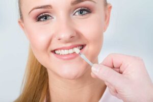 Veneers for a confident smile