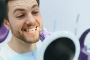 Veneers for smile makeover