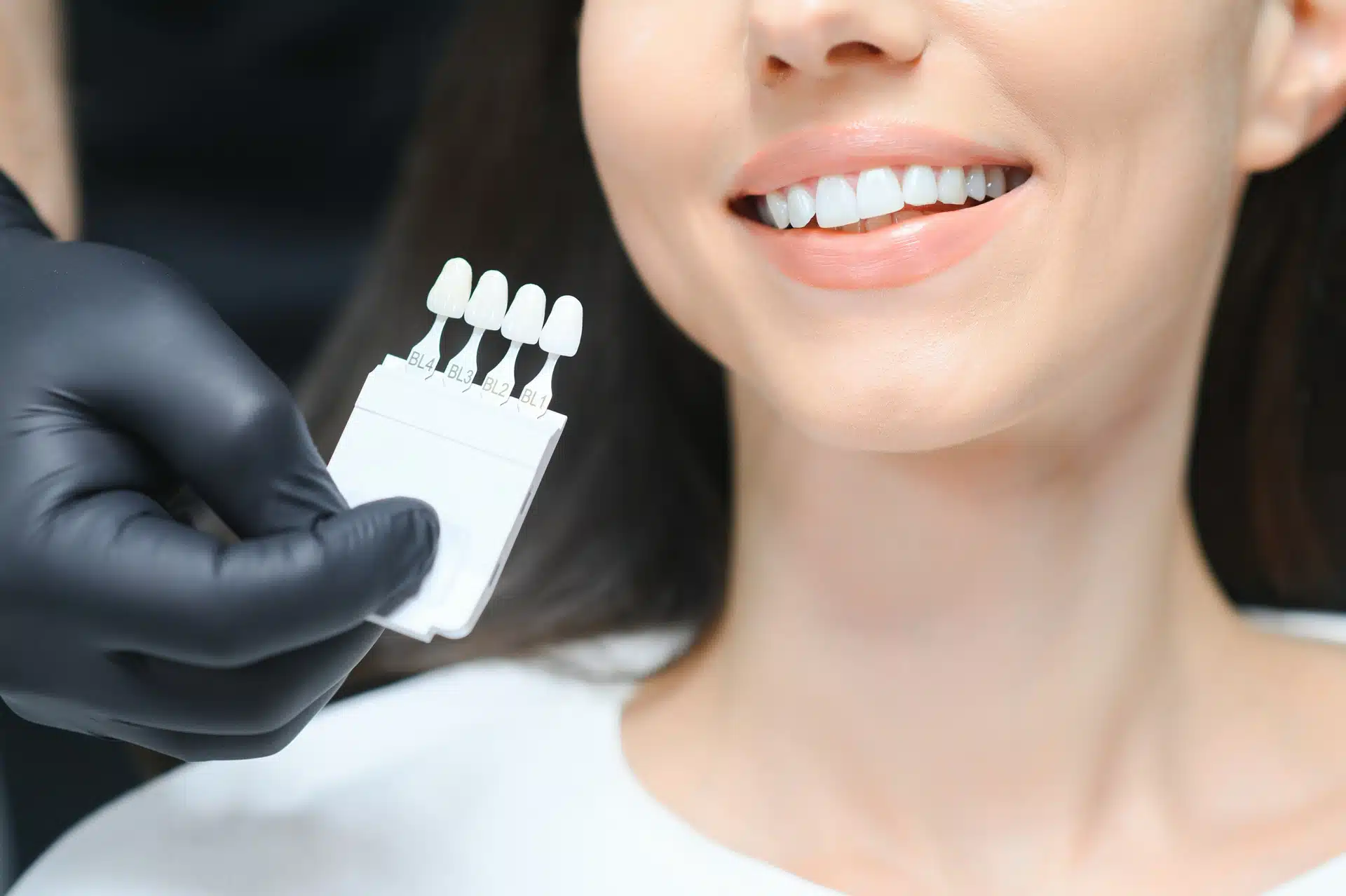 dentist holding dental veneers for patient