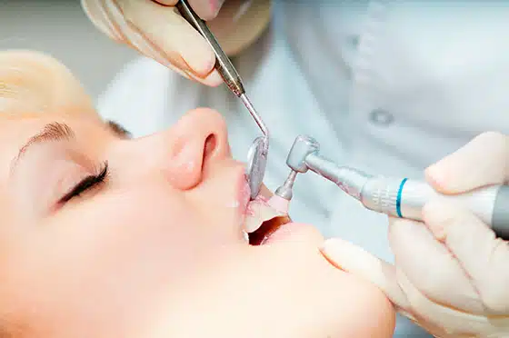 Broken tooth repair at Bonney Lake emergency dental clinic