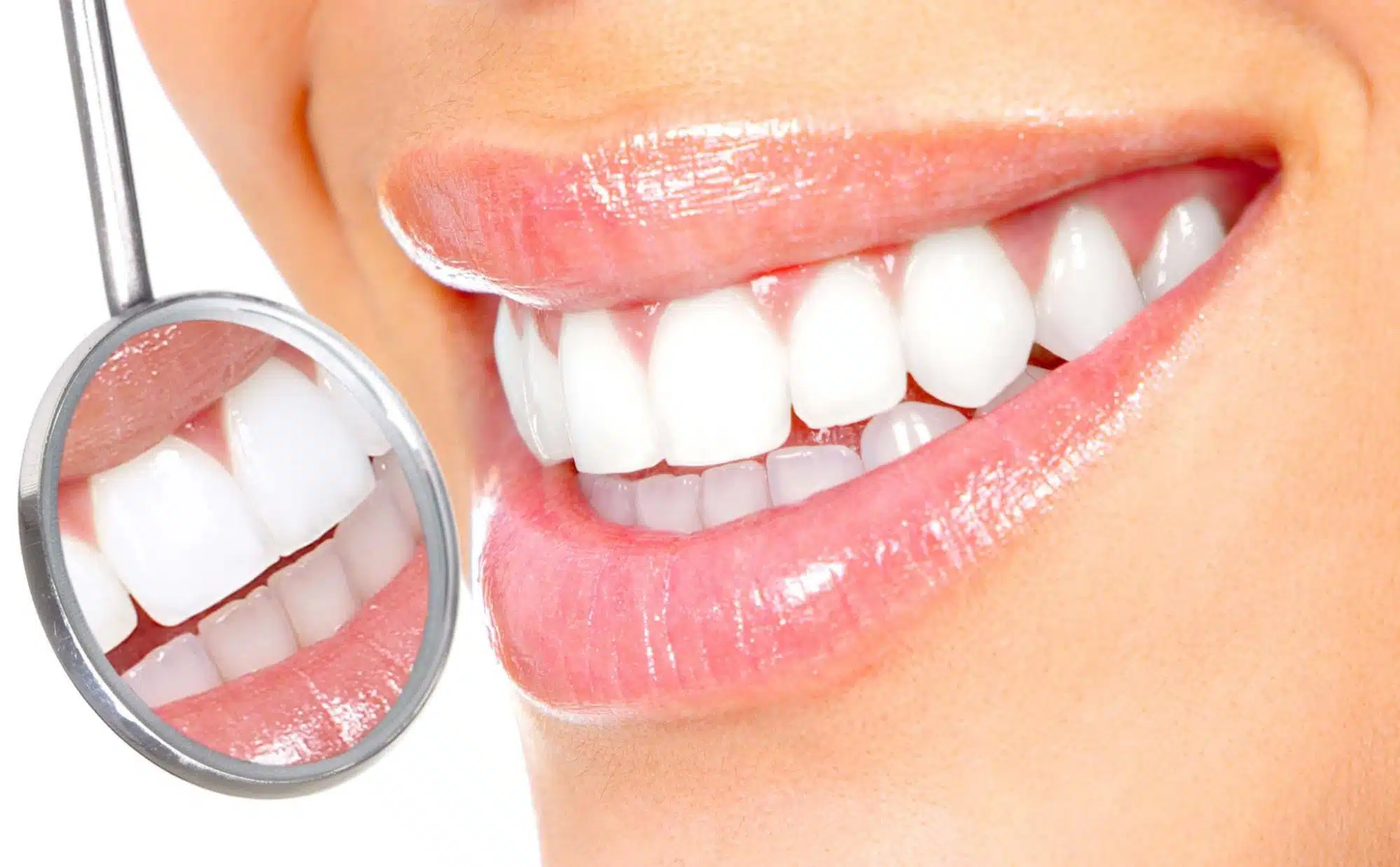 Root canal teeth whitening to improve darkened tooth color
