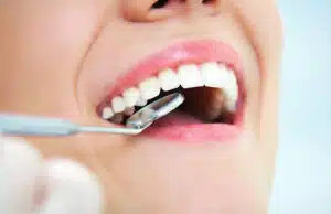 Dentist performing root canal teeth whitening treatment